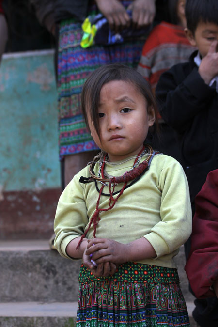 Tay chân các em lấm lem, nứt nẻ vì giá rét, thậm chí những bàn tay, bàn chân của các em phù nề vì giá rét/ Tay chân các em lấm lem, nứt nẻ vì giá rét, thậm chí những bàn tay, bàn chân của các em phù nề vì giá rét/