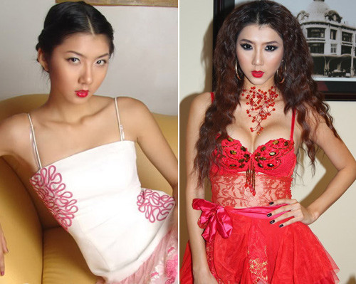 ... và phồng xẹp bất thường.