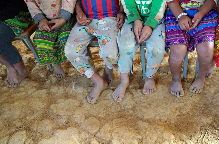 Những đôi chân bé nhỏ không mang dép Những đôi chân bé nhỏ không mang dép