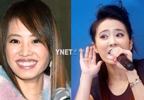 Thái Y Lâm trông già hẳn đi với gương mặt sần sùi