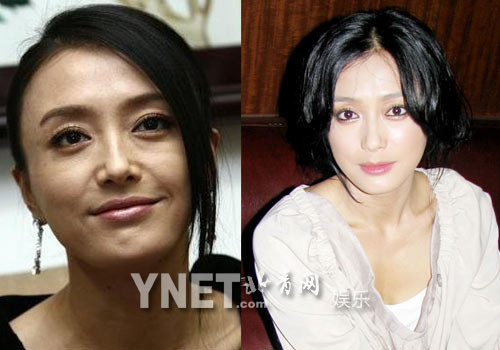 Tần Lam khi cười hoặc nhăn mặt sẽ bị lộ nếp nhăn Tần Lam khi cười hoặc nhăn mặt sẽ bị lộ nếp nhăn