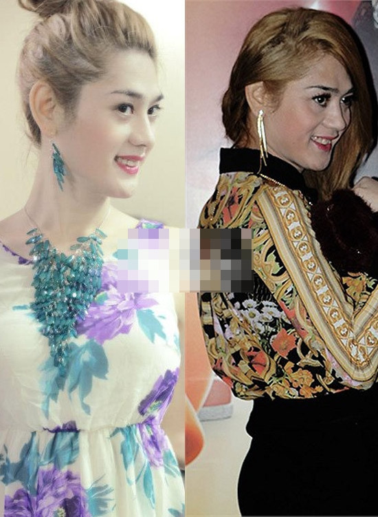 Ở góc nghiêng, phần xương hàm được gọt kỹ ngọt ngào, môi được bơm thêm, sống mũi cũng cao hơn bình thường