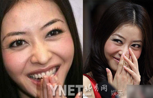 Hùng Đại Lâm với phần đuôi mắt quá nhiều vết chân chim Hùng Đại Lâm với phần đuôi mắt quá nhiều vết chân chim