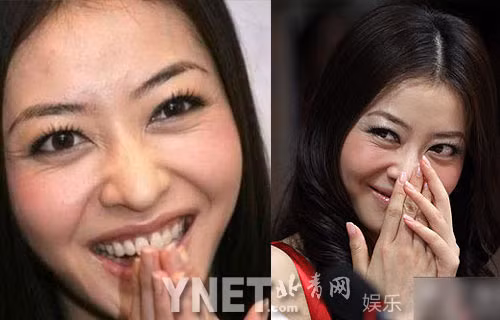 Hùng Đại Lâm với phần đuôi mắt quá nhiều vết chân chim