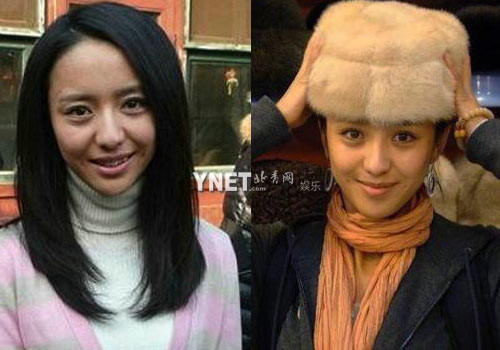 Đồng Lệ Á lộ rõ bọng mắt và vết chân chim Đồng Lệ Á lộ rõ bọng mắt và vết chân chim