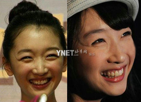 Chu Đông Vũ là sao 9x mới nổi nhưng mặt đã đầy nếp nhăn và chân chim Chu Đông Vũ là sao 9x mới nổi nhưng mặt đã đầy nếp nhăn và chân chim