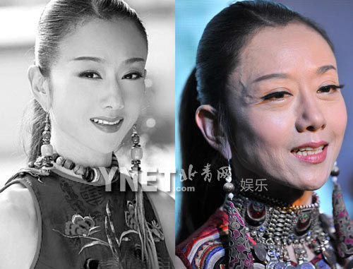 Dương Lệ Bình da mặt vừa nhăn vừa bị nổi gân Dương Lệ Bình da mặt vừa nhăn vừa bị nổi gân