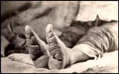 Tục bó chân ở giới thượng lưu phổ biến hơn, đối với tầng lớp nông dân, phải đi cày ruộng nên tục này xuất hiện muộn hơn.