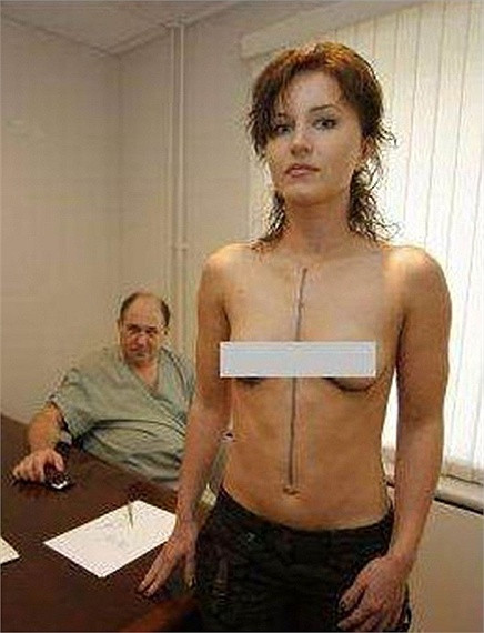 Sau khi xác định chính xác vị trí cần phẫu thuật Sau khi xác định chính xác vị trí cần phẫu thuật