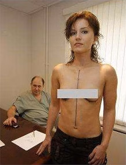 Sau khi xác định chính xác vị trí cần phẫu thuật