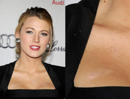 Blake Lively Blake Lively