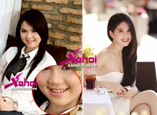 Tuy nhiên, trước khi được biết tới với danh xưng "nữ hoàng nội y" Việt, Ngọc Trinh cũng sở hữu khá nhiều khiếm khuyết. Thuở "hai lúa", Ngọc Trinh chưa có nước da trắng mịn như bây giờ và hàm răng thì ngả màu vàng ố chứ không trắng long lanh như mọi người vẫn thấy.