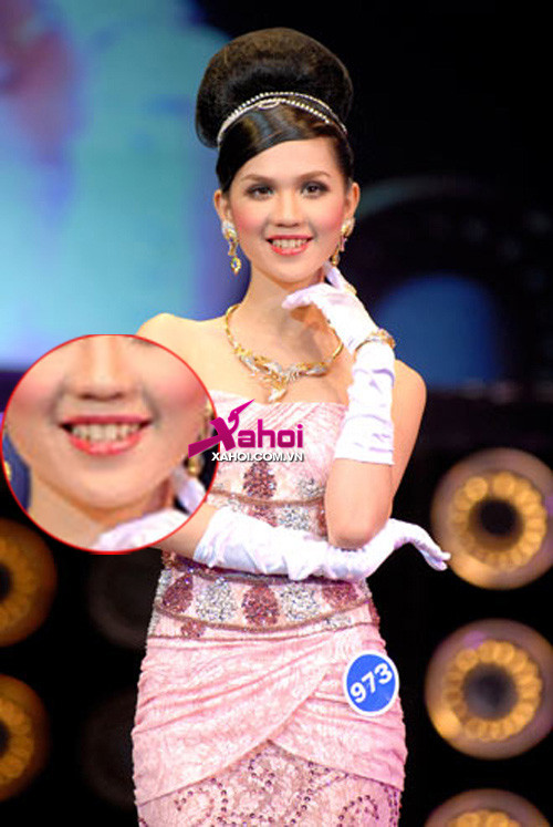 Cô vẫn giữ hàm răng tự nhiên chưa tẩy trắng cho tới tận năm 2007 khi tham gia cuộc thi Hoa hậu trang sức.