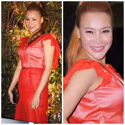 Hồ Quỳnh Hương đã từng bị đặt biệt danh "thảm họa dao kéo" khi xuất hiện với khuôn mặt sưng vù này