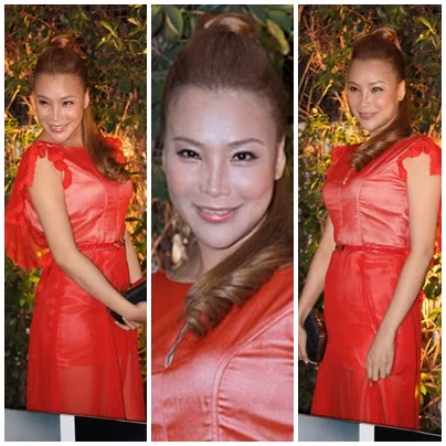 Cận cảnh gương mặt phù nề vì làm đẹp của Hồ Quỳnh Hương