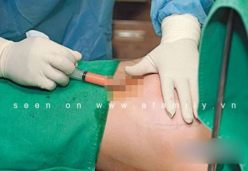 Trần Duy Thiên tâm sự: “Phẫu thuật xong, phần ngực của tôi bị thâm tím rất kinh khủng. Tôi đau đớn toàn thân. Chỉ đi bộ thôi, tôi đã thấy được nỗi đau đó tệ hại như thế nào. Các bác sĩ cho biết có thể phẫu thuật sẽ để lại sẹo mờ còn đau đớn sẽ thuyên giảm trong vòng một tuần. 3 ngày sau đại phẫu, tôi bắt đầu trở lại trường học. Dù gì tôi vẫn phải đảm bảo việc học tập của mình. Giờ, tôi có thể tự hào nói rằng tôi rất đẹp.”.