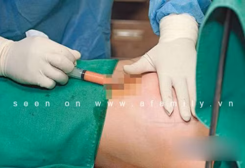 Trần Duy Thiên tâm sự: “Phẫu thuật xong, phần ngực của tôi bị thâm tím rất kinh khủng. Tôi đau đớn toàn thân. Chỉ đi bộ thôi, tôi đã thấy được nỗi đau đó tệ hại như thế nào. Các bác sĩ cho biết có thể phẫu thuật sẽ để lại sẹo mờ còn đau đớn sẽ thuyên giảm trong vòng một tuần. 3 ngày sau đại phẫu, tôi bắt đầu trở lại trường học. Dù gì tôi vẫn phải đảm bảo việc học tập của mình. Giờ, tôi có thể tự hào nói rằng tôi rất đẹp.”.