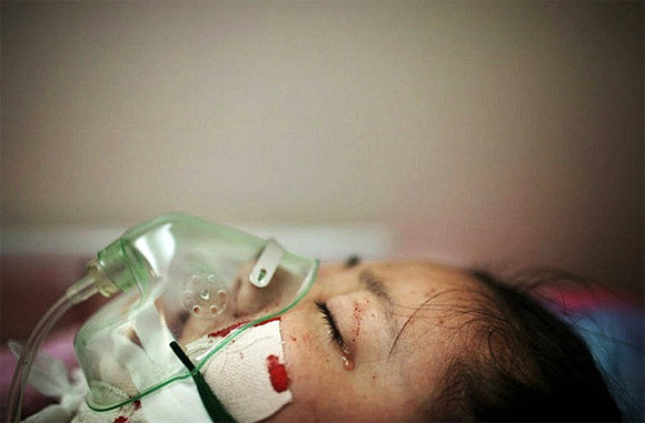 Bức ảnh thể hiện rõ sự đau đớn và sợ hãi của cô gái khi trải qua cuộc trùng tu nhan sắc