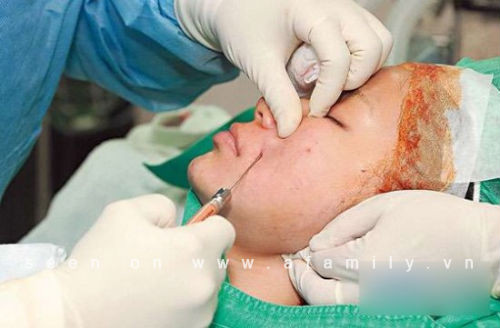 Bác sĩ đang tiến hành hút mỡ, chỉnh mặt và nâng mông, nâng ngực cho Trần Duy Thiên