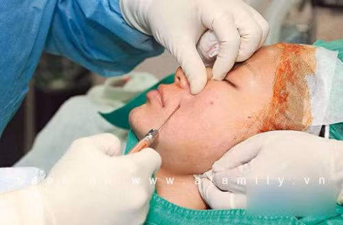 Bác sĩ đang tiến hành hút mỡ, chỉnh mặt và nâng mông, nâng ngực cho Trần Duy Thiên