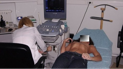 Hãi hùng nhất phải kể đến màn hút mỡ căng da bụng