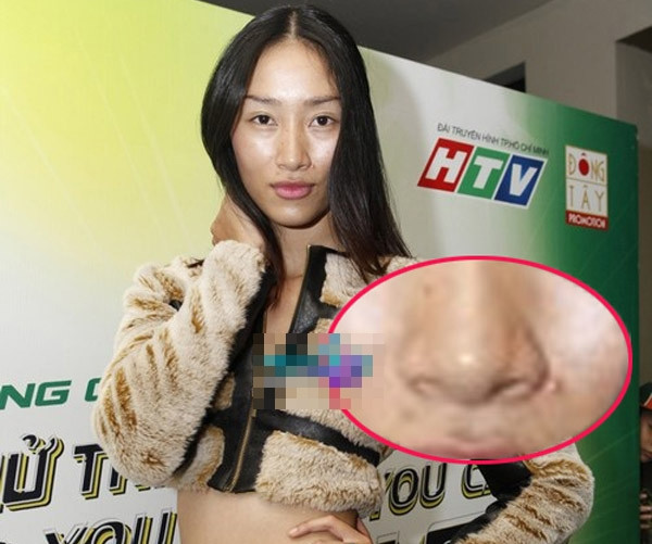 Không chỉ gây sốc bởi mặt mộc nhợt nhạt, Huyền Trang còn bị chê xấu xí vì mụn và vết thâm.