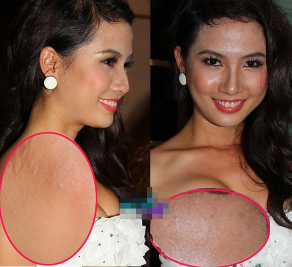 Phan Thị Mơ mất điểm vì làn da bóng nhẫy và sần sùi.