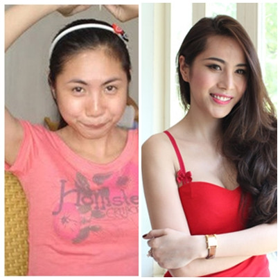 Cả khuôn mặt, đến nước da của cô đều biến hóa lạ lùng Cả khuôn mặt, đến nước da của cô đều biến hóa lạ lùng