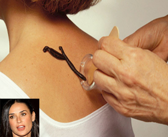 Demi Moore cho đỉa hút máu để giải độc, gìn giữ nét trẻ trung.