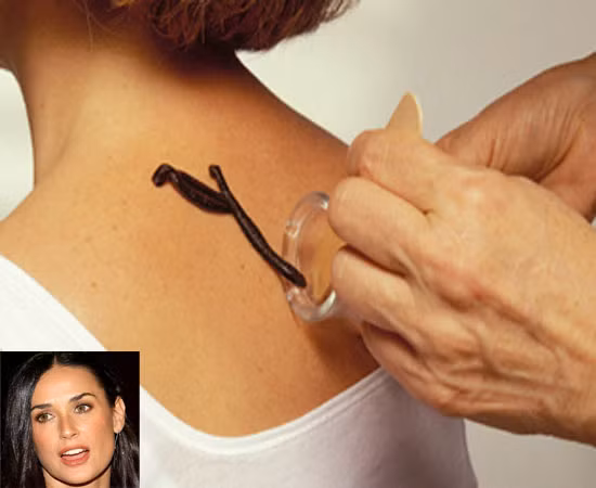 Demi Moore cho đỉa hút máu để giải độc, gìn giữ nét trẻ trung.
