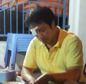 Một thành viên trong đoàn sau khi bị khán giả tấn công. Ảnh: Vũ Trang (Vnexpress).