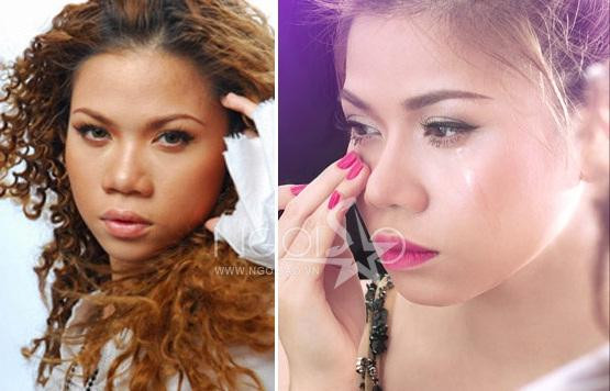 Chiếc mũi sư tử của Mỹ Dung đã được nâng cao và thu gọn. Nó khiến gương mặt của Mỹ Dung bớt thô và trở nên xinh đẹp hơn rất nhiều. Chiếc mũi sư tử của Mỹ Dung đã được nâng cao và thu gọn. Nó khiến gương mặt của Mỹ Dung bớt thô và trở nên xinh đẹp hơn rất nhiều.