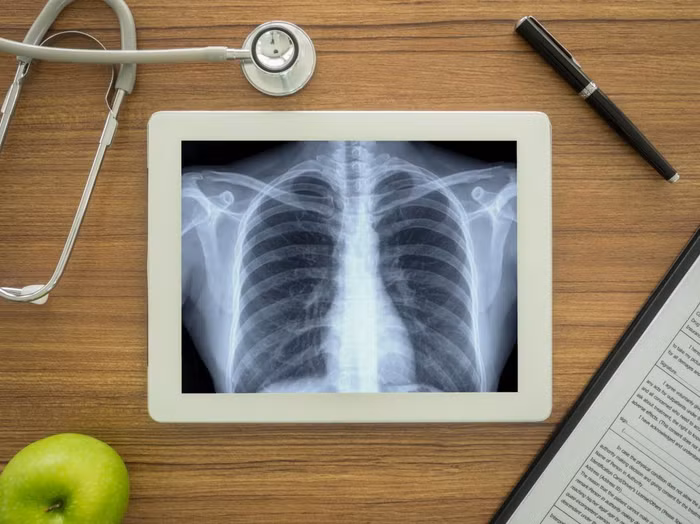 Theo những nghiên cứu gần đây, các nhà khoa học đã chỉ ra rằng việc bổ sung chất chống oxy hóa như vitamin E, có thể khiến ung thư lan nhanh hơn. Ảnh: Medicalnewstoday Theo những nghiên cứu gần đây, các nhà khoa học đã chỉ ra rằng việc bổ sung chất chống oxy hóa như vitamin E, có thể khiến ung thư lan nhanh hơn. Ảnh: Medicalnewstoday