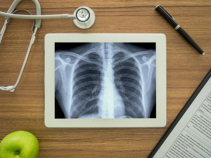 Theo những nghiên cứu gần đây, các nhà khoa học đã chỉ ra rằng việc bổ sung chất chống oxy hóa như vitamin E, có thể khiến ung thư lan nhanh hơn. Ảnh: Medicalnewstoday Theo những nghiên cứu gần đây, các nhà khoa học đã chỉ ra rằng việc bổ sung chất chống oxy hóa như vitamin E, có thể khiến ung thư lan nhanh hơn. Ảnh: Medicalnewstoday