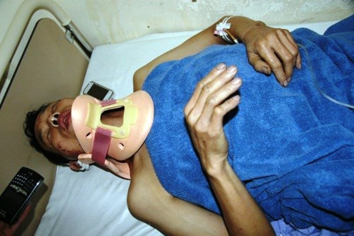 Nạn nhân Nguyễn Văn Hướng. Nạn nhân Nguyễn Văn Hướng.