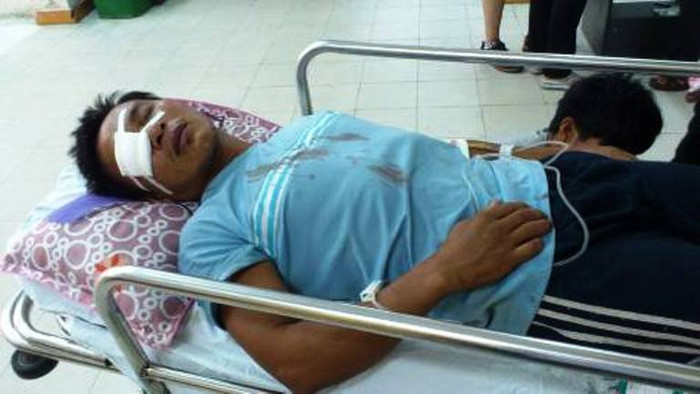 Anh Lê Văn Dũng bị nhóm đối tượng tấn công bằng súng khi đang hành nghề giã cào trên biển làm anh bị thương nặng