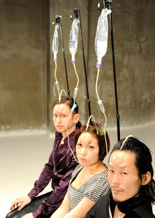 Sau 2 tiếng truyền 400 cc dung dịch saline trán sẽ tự phồng lên.