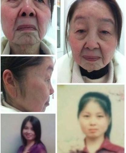 Hình ảnh phụ nữ trước và sau khi phẫu thuật thẫm mỹ. Hình ảnh phụ nữ trước và sau khi phẫu thuật thẫm mỹ.