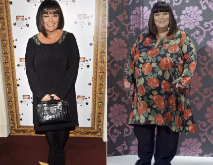 Sau khi trải qua một sự thay đổi lớn trong chế độ ăn uống và tập thể dục, người phụ nữ hài hước nhất nước Anh - Dawn French đã có sự thay đổi lớn. Cô ấy trông đẹp hơn rất nhiều với cơ thể thon thả hơn mà không gầy gò. Gu thời trang của cô cũng thay đổi rất nhiều theo chiều hướng tính cực: Cô chọn chiếc váy xuông, cổ tròn rộng, cắt cúp vừa vặn đi kèm với những phụ kiện tối màu ton-sur-ton để có một hình ảnh gọn gàng và sang trọng.