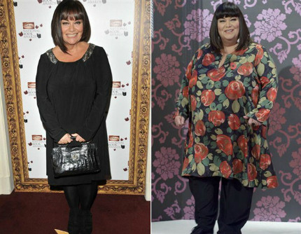 Sau khi trải qua một sự thay đổi lớn trong chế độ ăn uống và tập thể dục, người phụ nữ hài hước nhất nước Anh - Dawn French đã có sự thay đổi lớn. Cô ấy trông đẹp hơn rất nhiều với cơ thể thon thả hơn mà không gầy gò. Gu thời trang của cô cũng thay đổi rất nhiều theo chiều hướng tính cực: Cô chọn chiếc váy xuông, cổ tròn rộng, cắt cúp vừa vặn đi kèm với những phụ kiện tối màu ton-sur-ton để có một hình ảnh gọn gàng và sang trọng. Sau khi trải qua một sự thay đổi lớn trong chế độ ăn uống và tập thể dục, người phụ nữ hài hước nhất nước Anh - Dawn French đã có sự thay đổi lớn. Cô ấy trông đẹp hơn rất nhiều với cơ thể thon thả hơn mà không gầy gò. Gu thời trang của cô cũng thay đổi rất nhiều theo chiều hướng tính cực: Cô chọn chiếc váy xuông, cổ tròn rộng, cắt cúp vừa vặn đi kèm với những phụ kiện tối màu ton-sur-ton để có một hình ảnh gọn gàng và sang trọng.