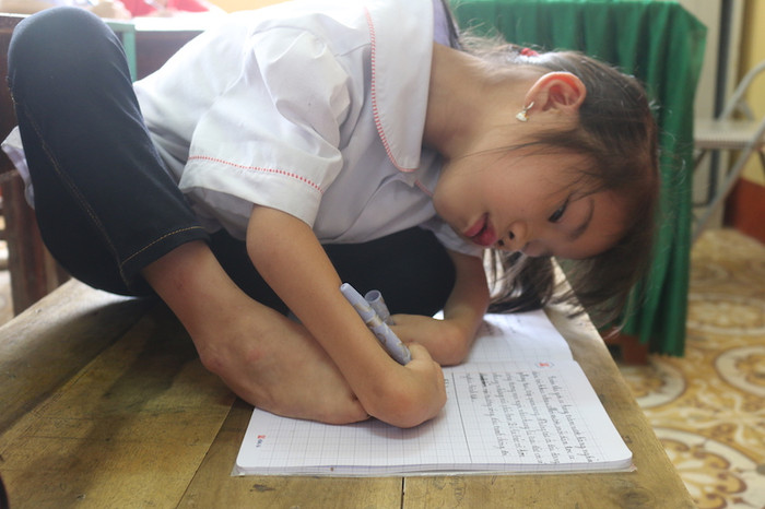 Em Trần Thị Hoa phải viết bằng chân và tay kết hợp Em Trần Thị Hoa phải viết bằng chân và tay kết hợp