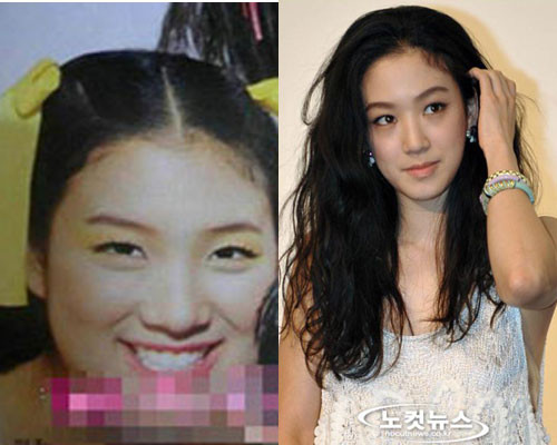 Jung Ryeo Won trước và sau khi gia nhập giới showbiz. Jung Ryeo Won trước và sau khi gia nhập giới showbiz.