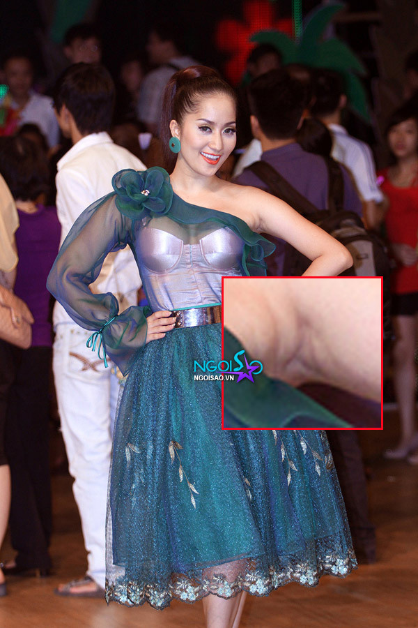 Vùng da dưới cánh tay của Khánh Thi nhiều nếp nhăn.