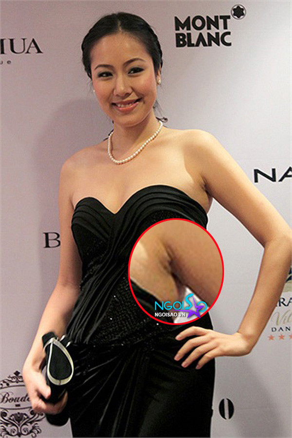 Ngô Phương Lan cần chăm sóc vùng da dưới cánh tay cẩn thận hơn nữa.