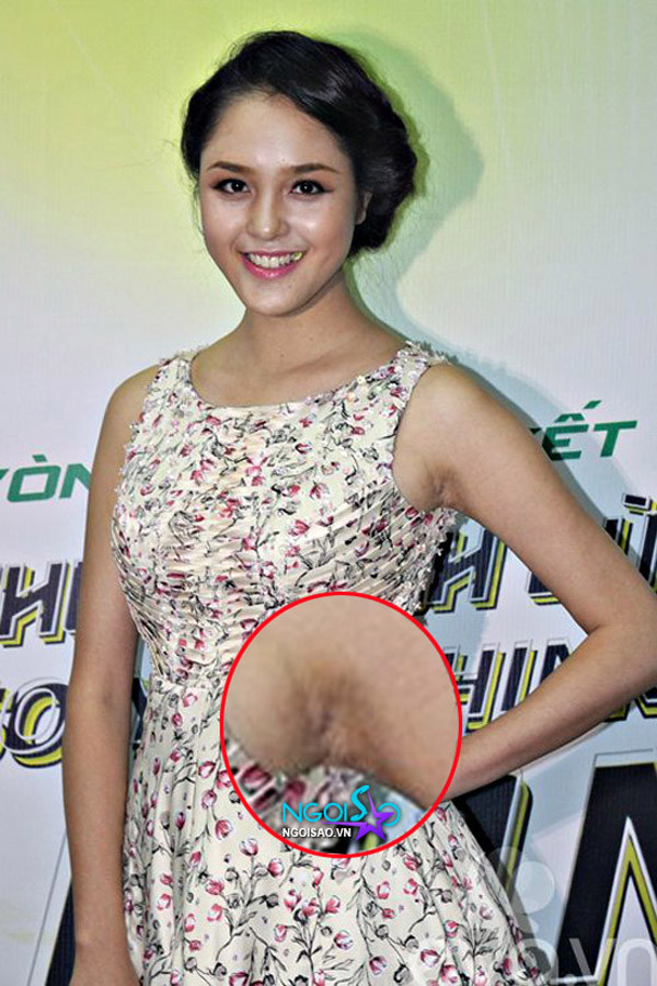 Vùng da dưới cánh tay của Hoàng Anh đen sạm hơn hẳn.