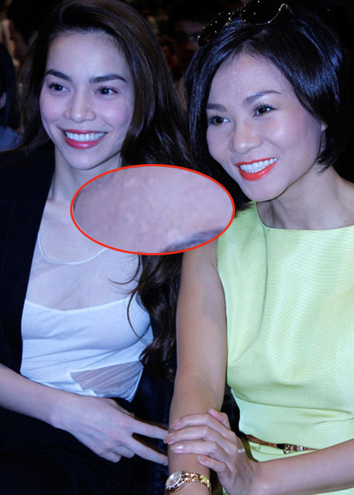 Dù trang điểm rất kỹ nhưng Thu Minh không thể giấu được đám mụn dày đặc ở trán.