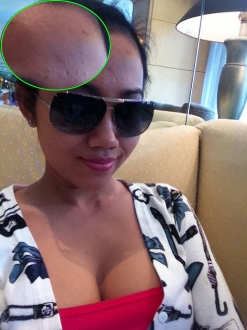 Không chỉ lộ mụn,...