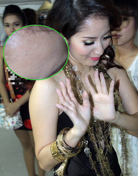 Khánh Thy 'lộ' làn da sần sùi, xấu như da cóc.