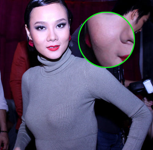 Dù 'ngụy trang' rất kỹ nhưng Dương Yến Ngọc không thể che được mụn ở 2 bên gò má.