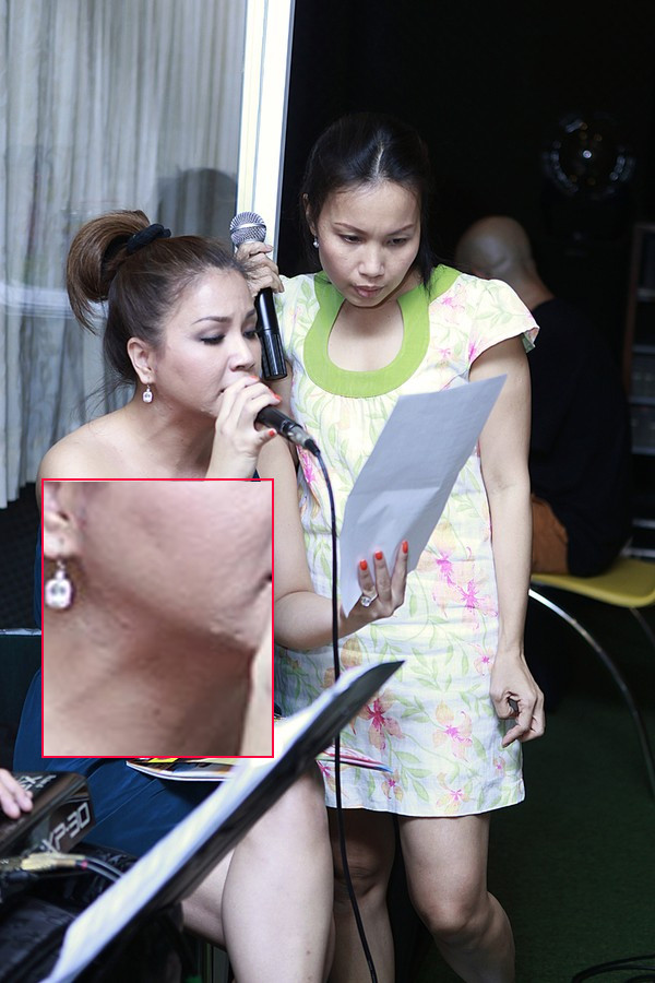 Làn da của ca sĩ Minh Tuyết thô, sần một cách đáng sợ.